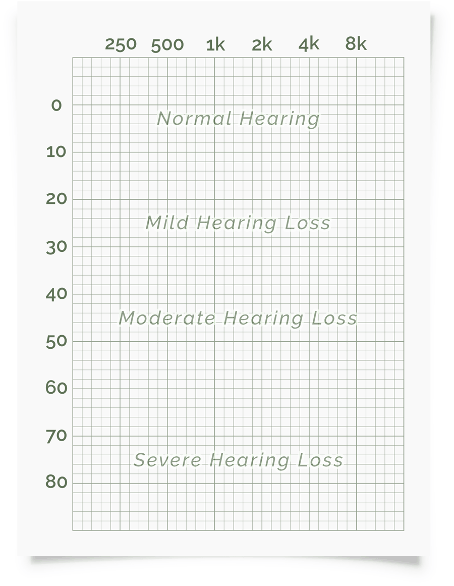 Online Hearing Test U0026 Audiogram Printout Online Hearing Test U0026 Audiogram Printout