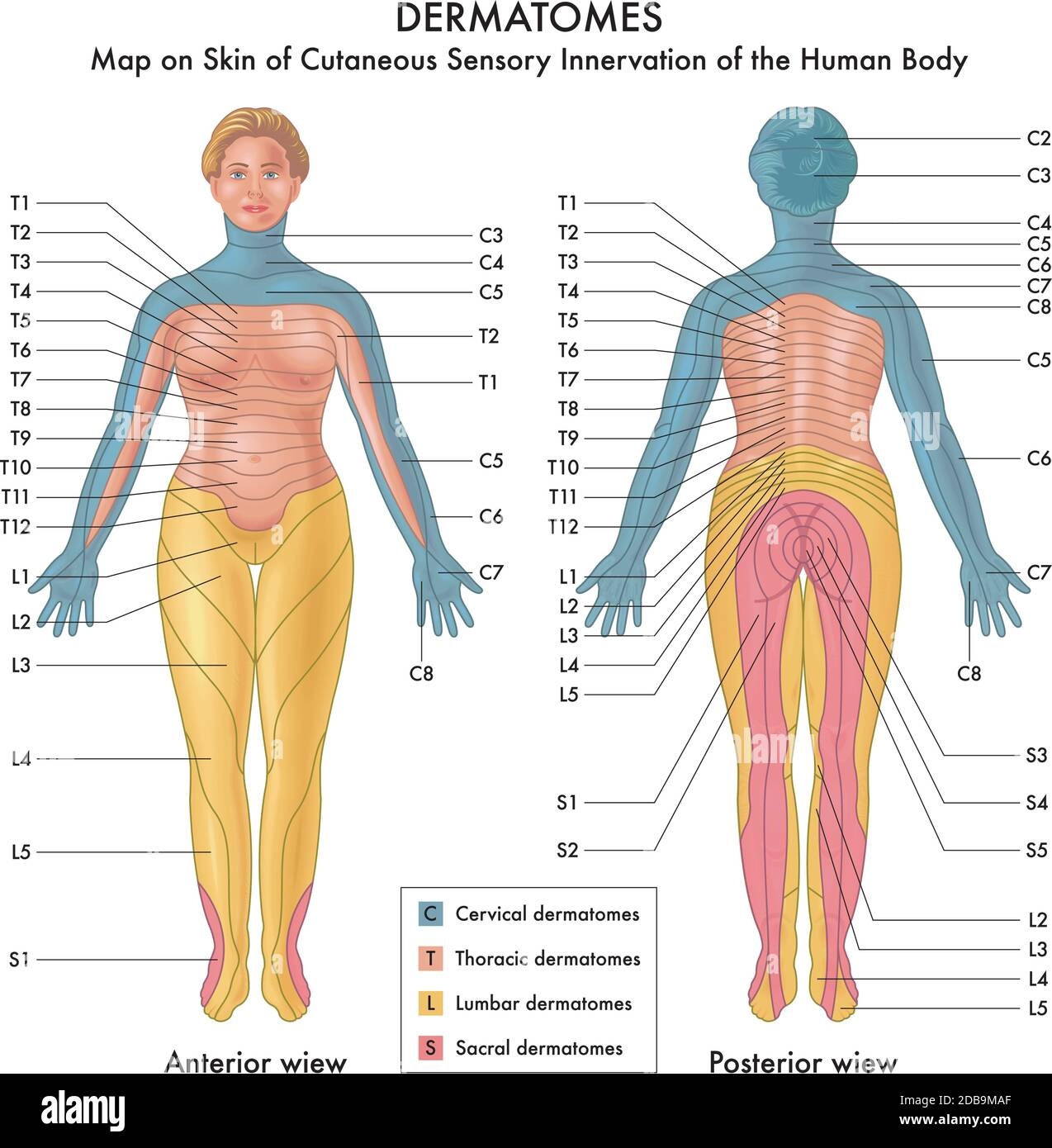 Dermatome Map Human Dermatomes Anatomical Chart Medical Reference Poster For Nerve Pathways Of Upper Limb