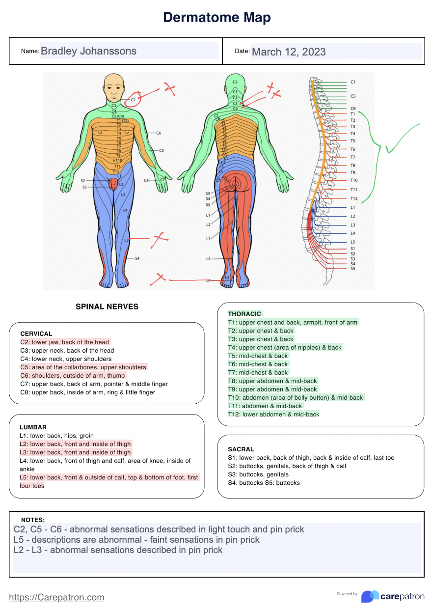 Dermatomes Anatomical Chart Printable Spinal Cord And Dermatome Map Poster Dermatomes Pdf