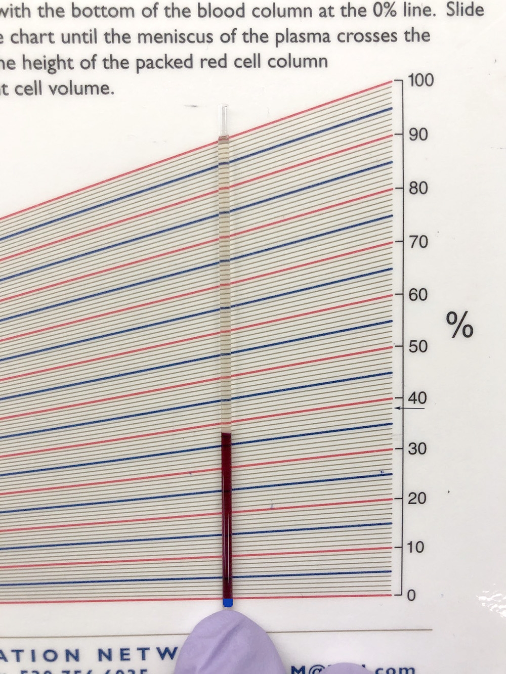 Reading A Packed Cell Volume EClinpath